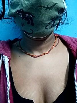 Anaya-Singh