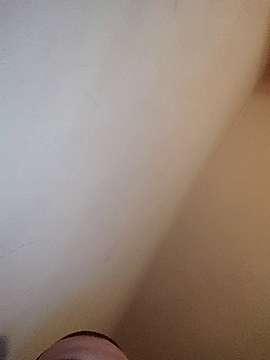 gaperholes
